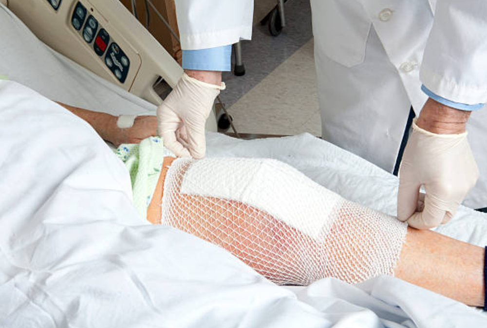 Top 5 Tips  for Knee Surgery Preparation